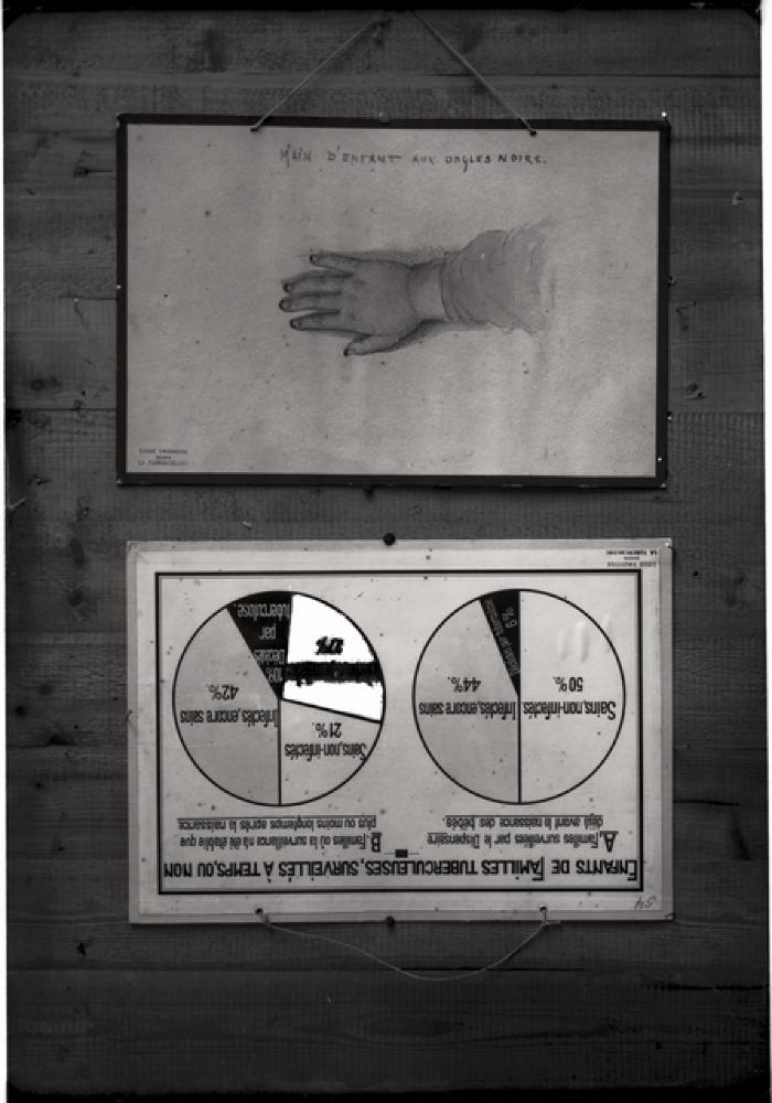 Document pédagogique dédié à l'information du public, statistiques (tuberculose et surveillance médicale).